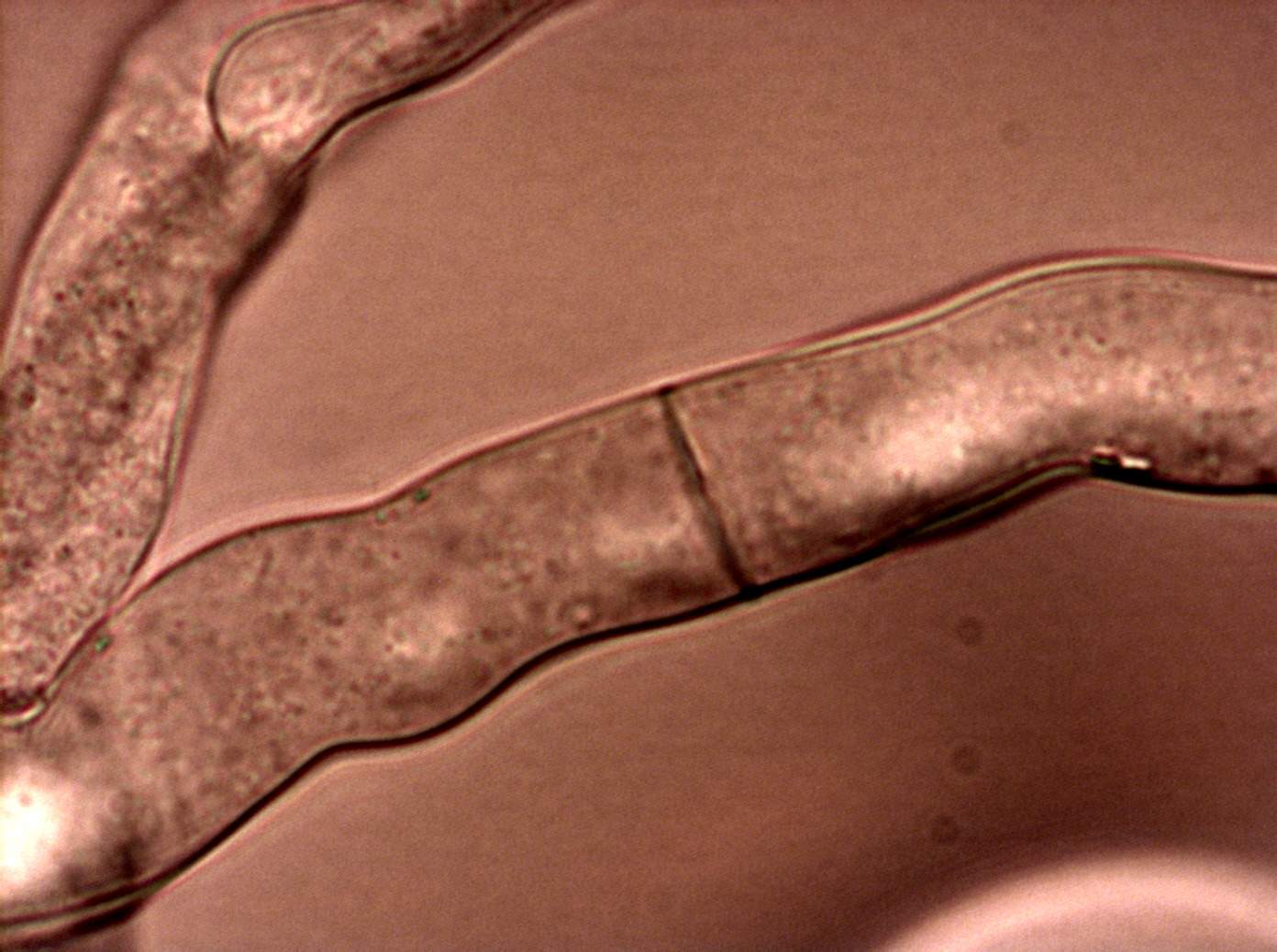 Microscope image of Neurospora crassa fungal hyphae, the mycelium used to make Rhiza