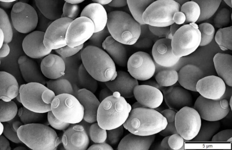 Scanning electron micrograph of Saccharomyces cerevisiae yeast cells